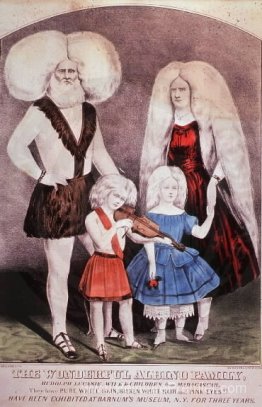 La merveilleuse famille albinos